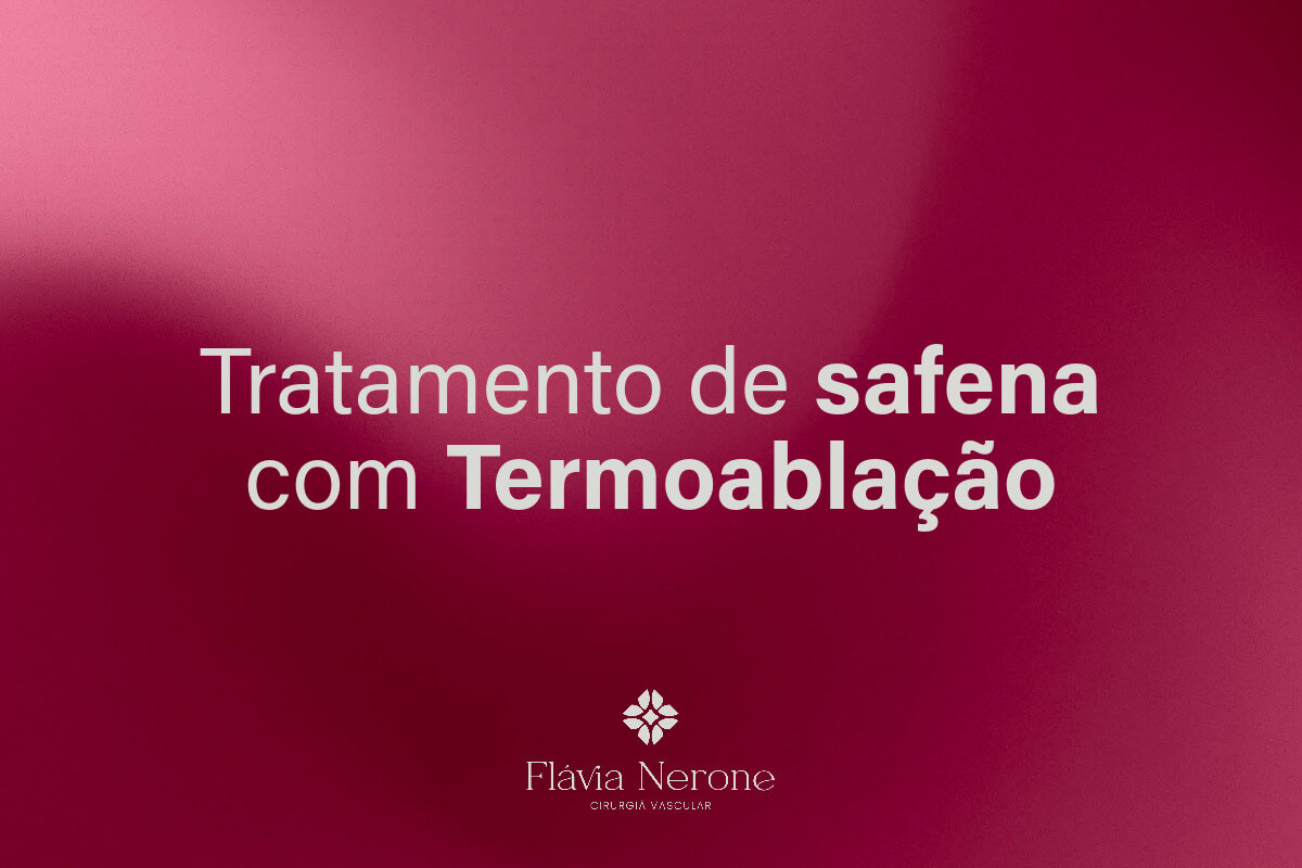 Tratamento de safena com termoablação