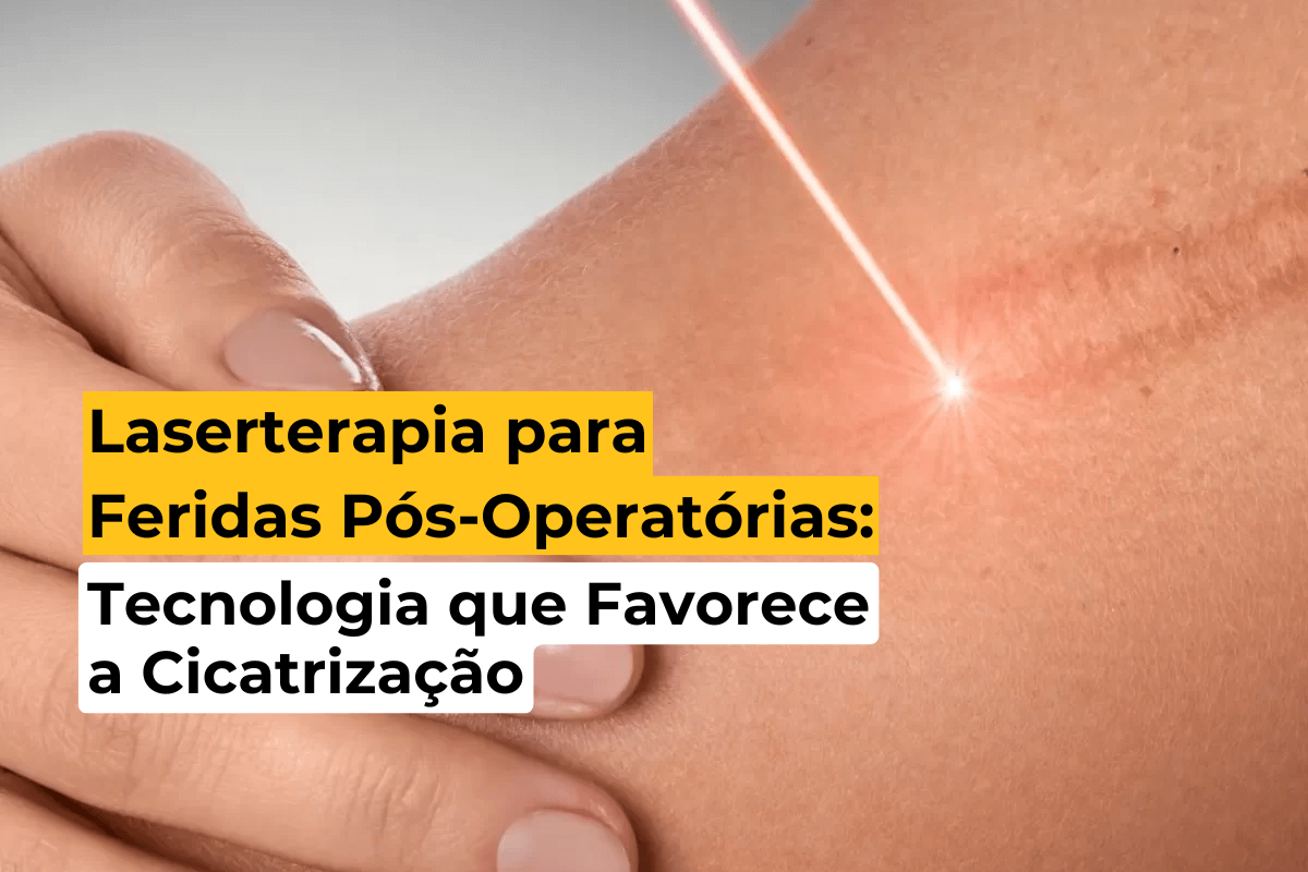 Laserterapia para Feridas Pós-Operatórias em Maringá: Tecnologia que Favorece a Cicatrização