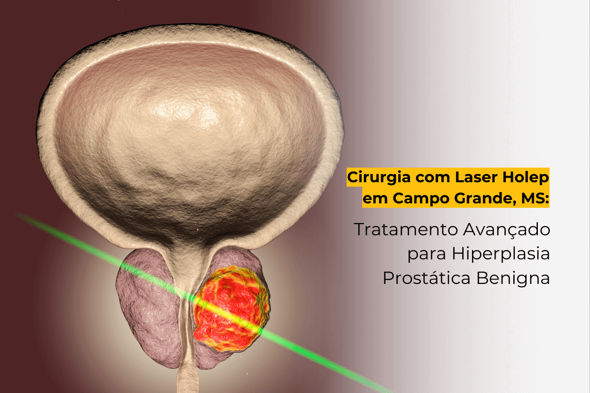 Cirurgia com Laser Holep em Campo Grande, MS: Tratamento Avançado para Hiperplasia Prostática Benigna