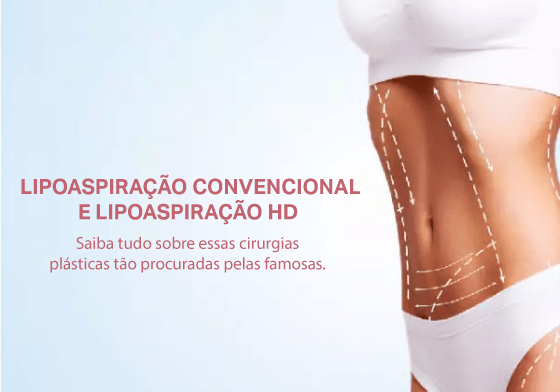 Lipoaspiração Convencional e Lipoaspiração HD