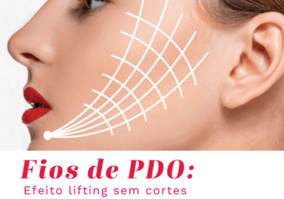 Fios de PDO: Efeito Lifting sem cortes