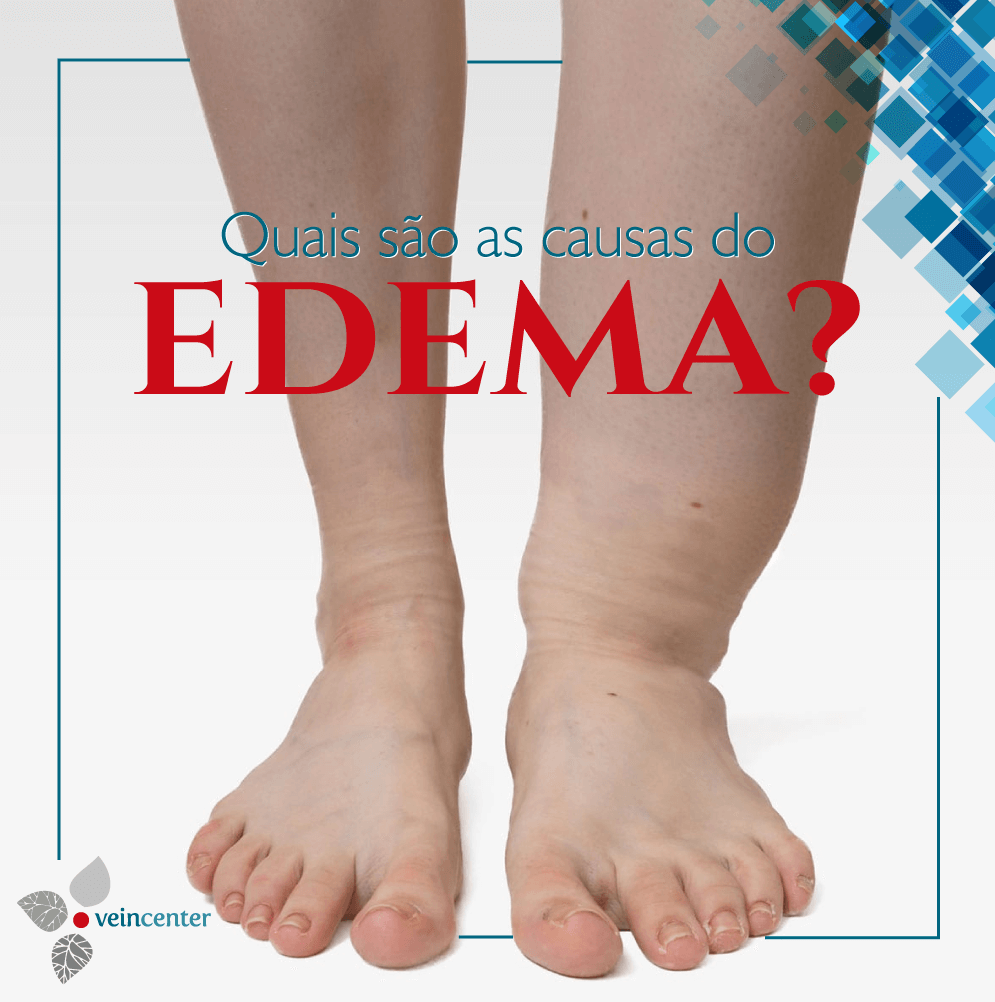 Quais são as causas dos edemas?
