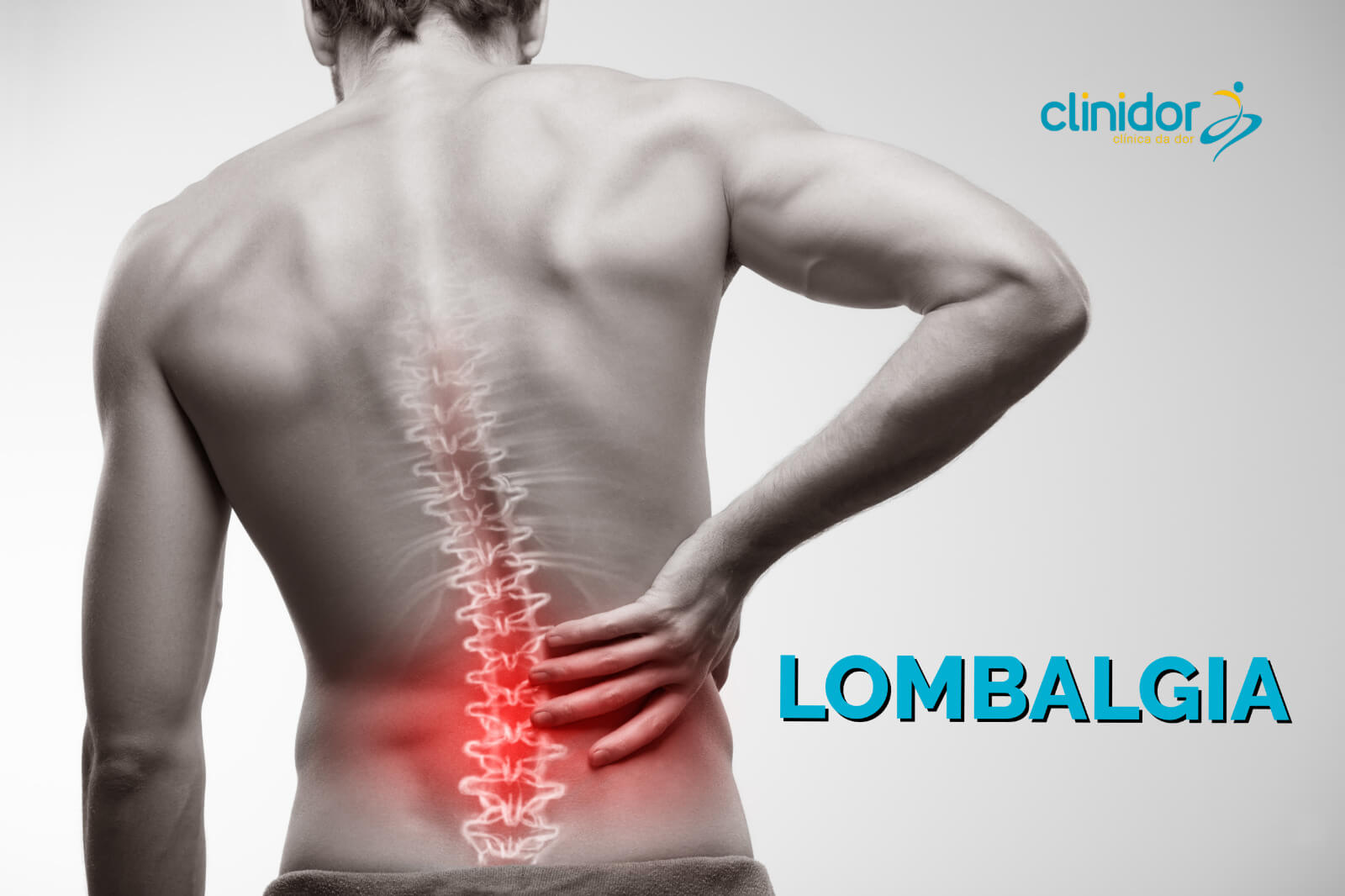 Lombalgia