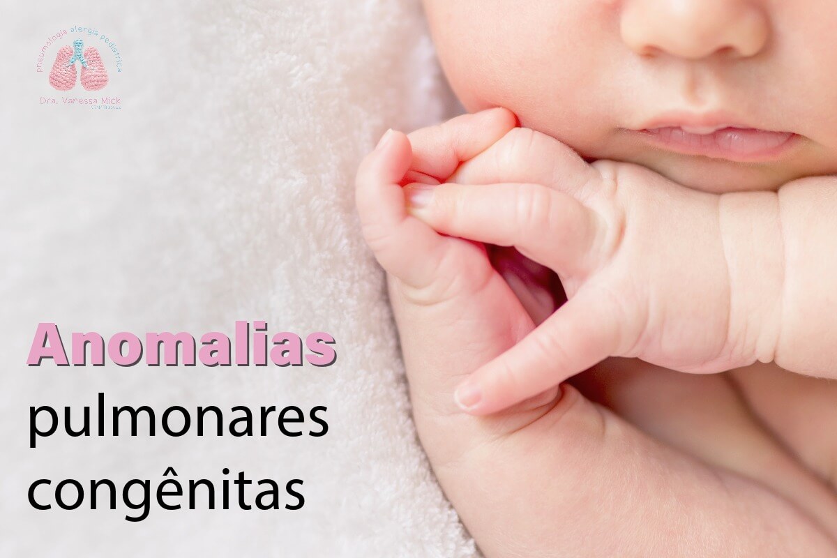 Anomalias pulmonares congênitas 