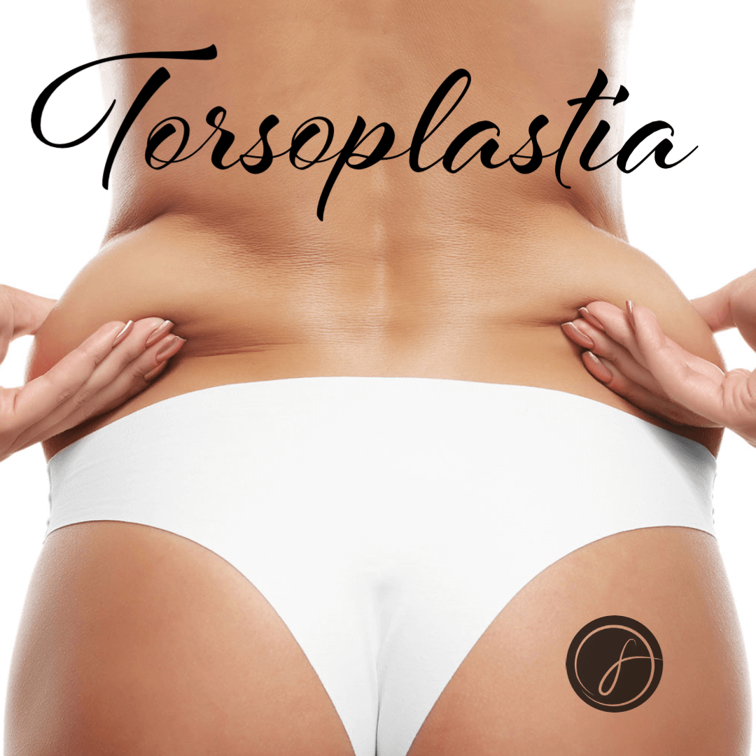 Torsoplastia: o que é e quando é indicada?