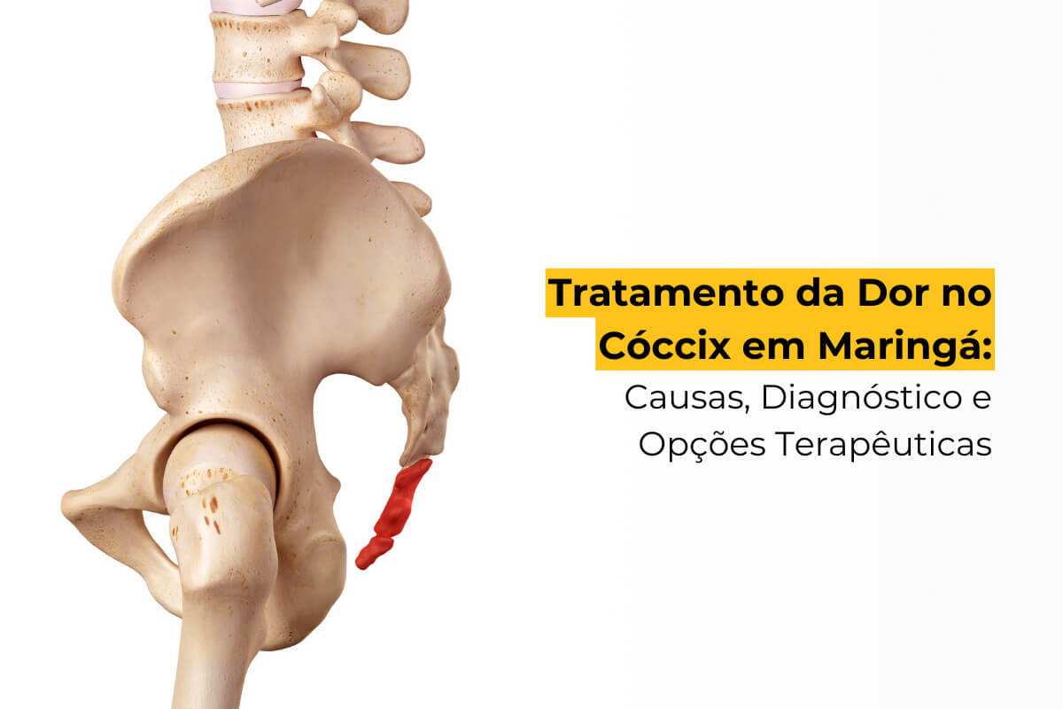 Tratamento da Dor no Cóccix em Maringá: Causas, Diagnóstico e Opções Terapêuticas