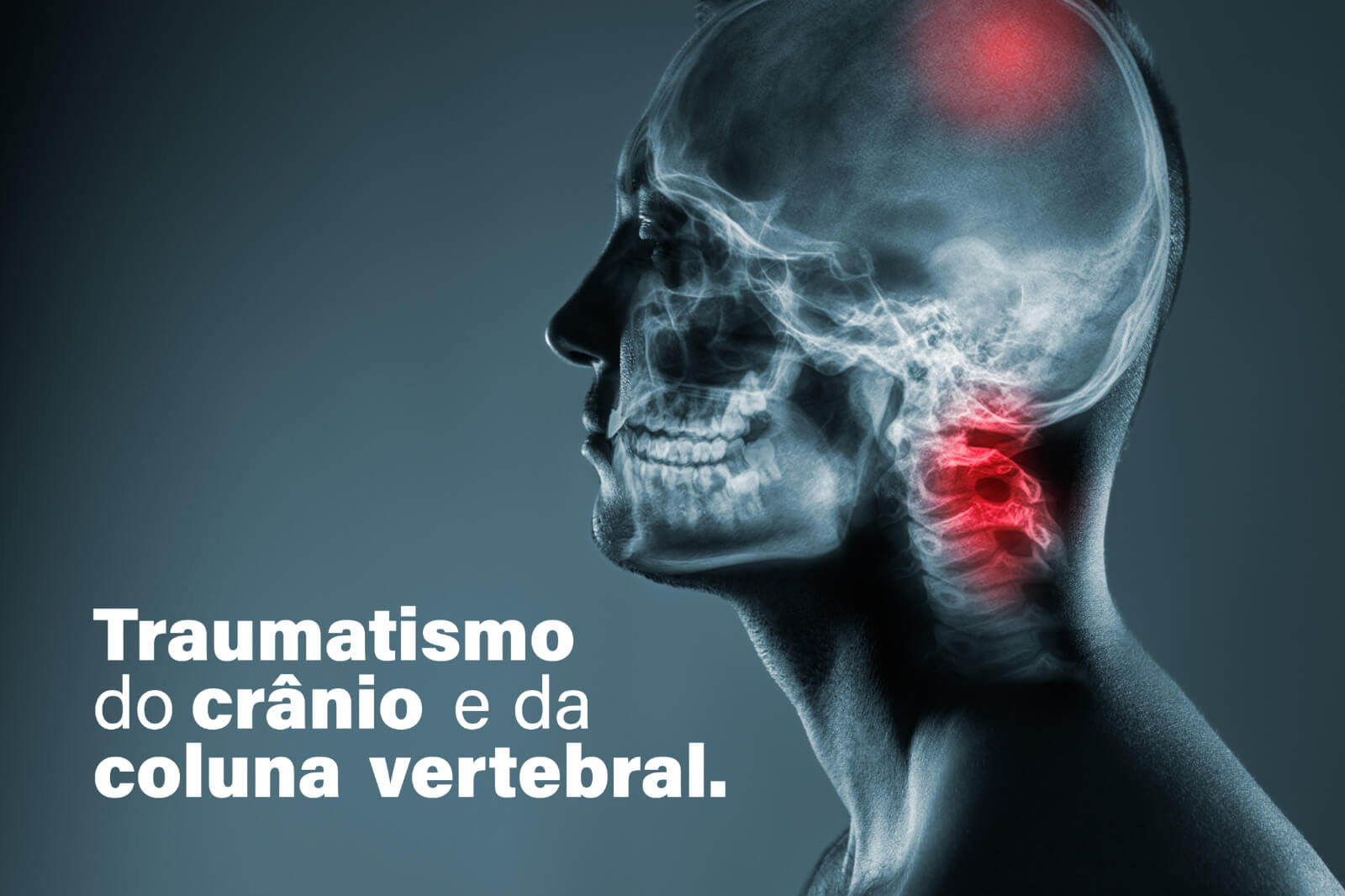 Traumatismo do crânio e da coluna vertebral