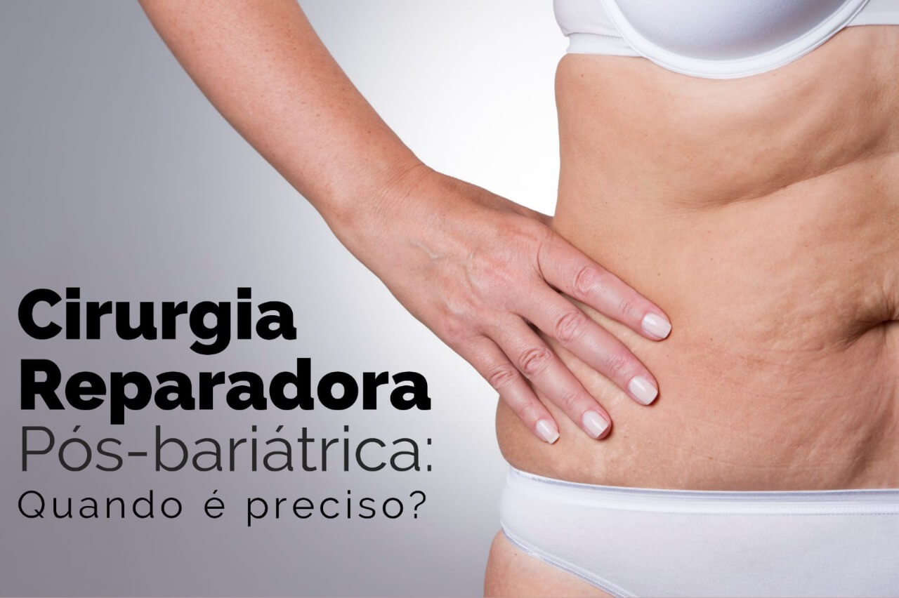Cirurgia reparadora pós-bariátrica: Quando é preciso?