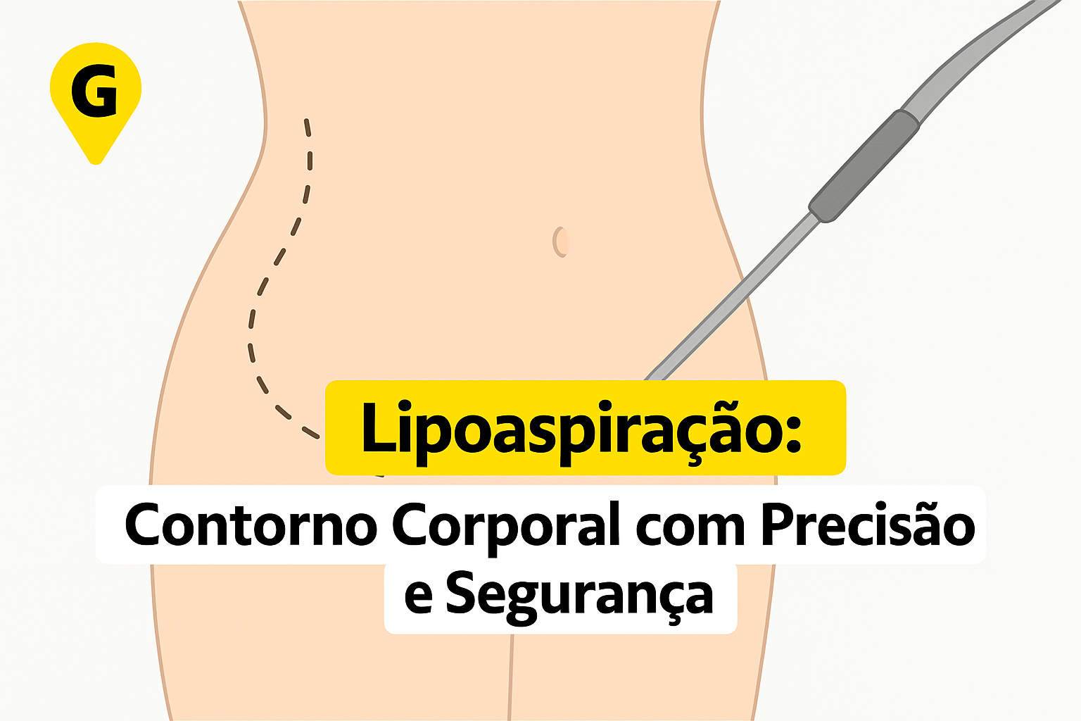Lipoaspiração Em Uberlândia: Contorno Corporal Com Precisão E Segurança