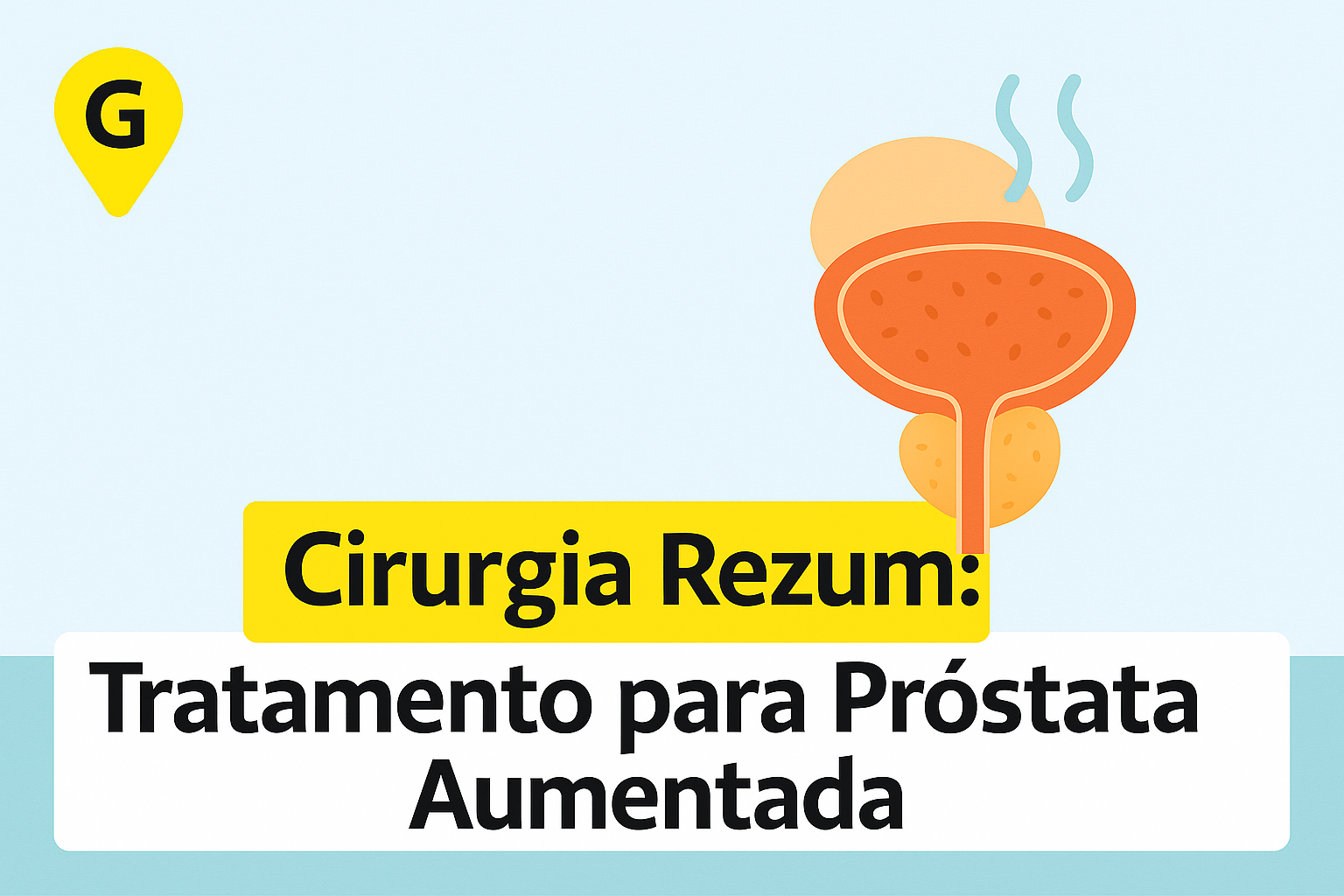 Cirurgia Rezum em Maringá: Tratamento para Próstata Aumentada