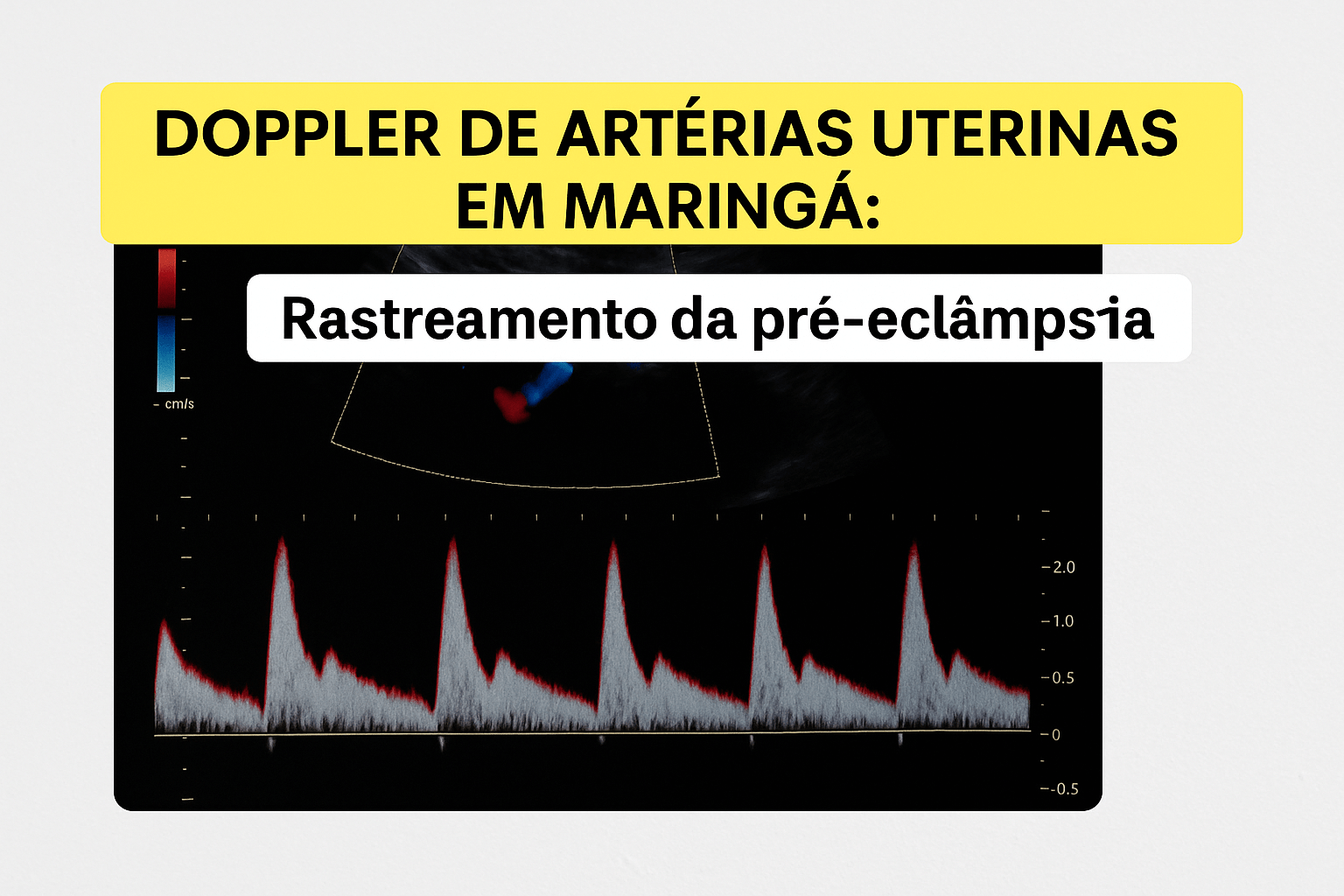 Doppler de Artérias Uterinas Maringá: Rastreio da Pré-Eclâmpsia