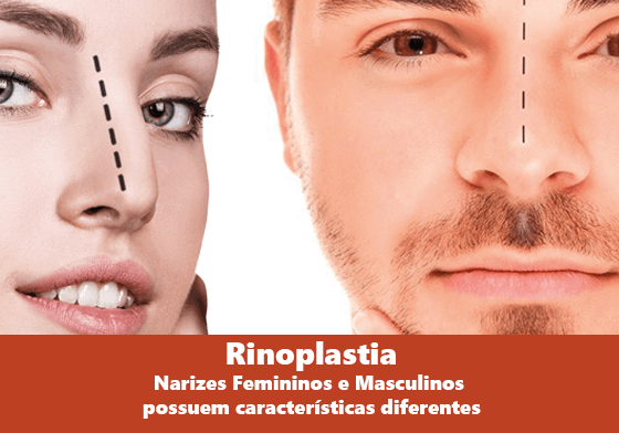 Rinoplastia:  Narizes Femininos e Masculinos possuem características diferentes. 