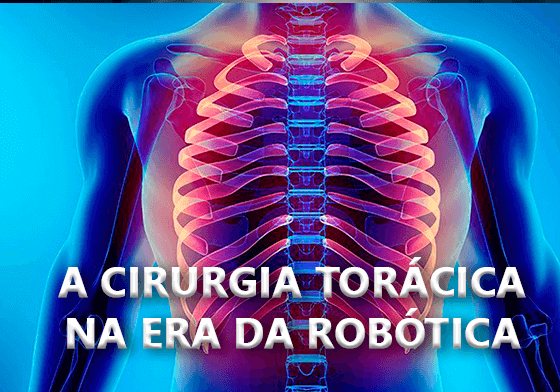 A Cirurgia Torácica na Era da Robótica