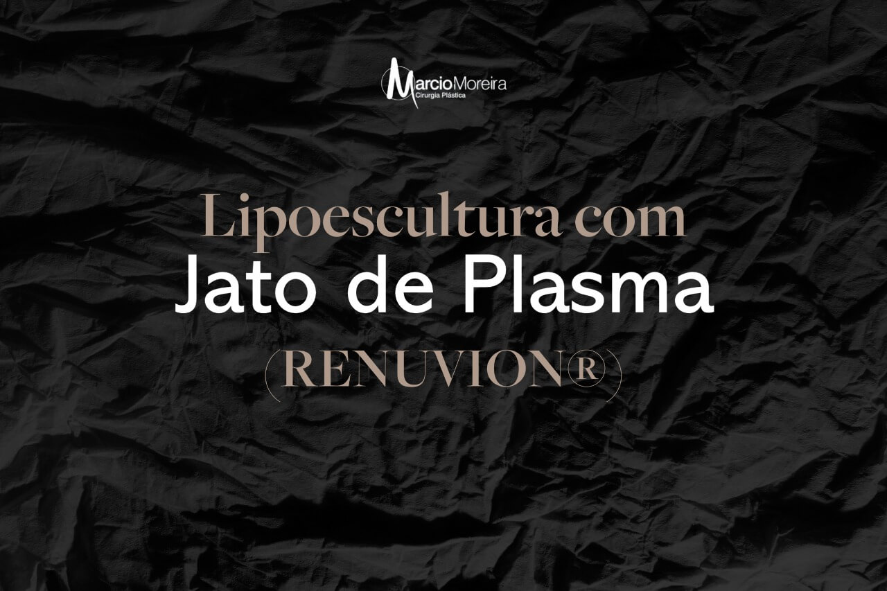Lipoescultura com Jato de plasma (Renuvion®)