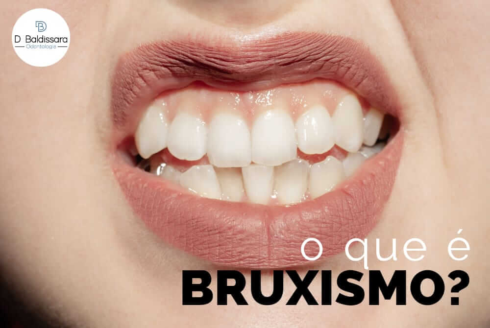 O que é Bruxismo?