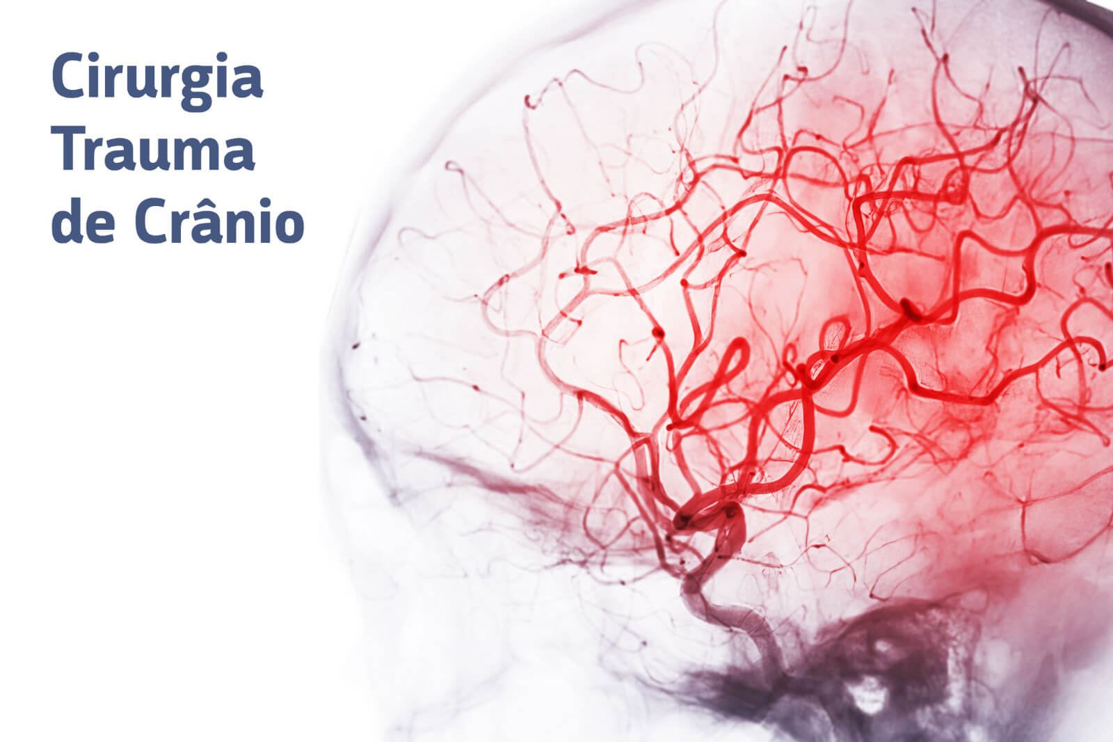 Cirurgia Trauma de Crânio