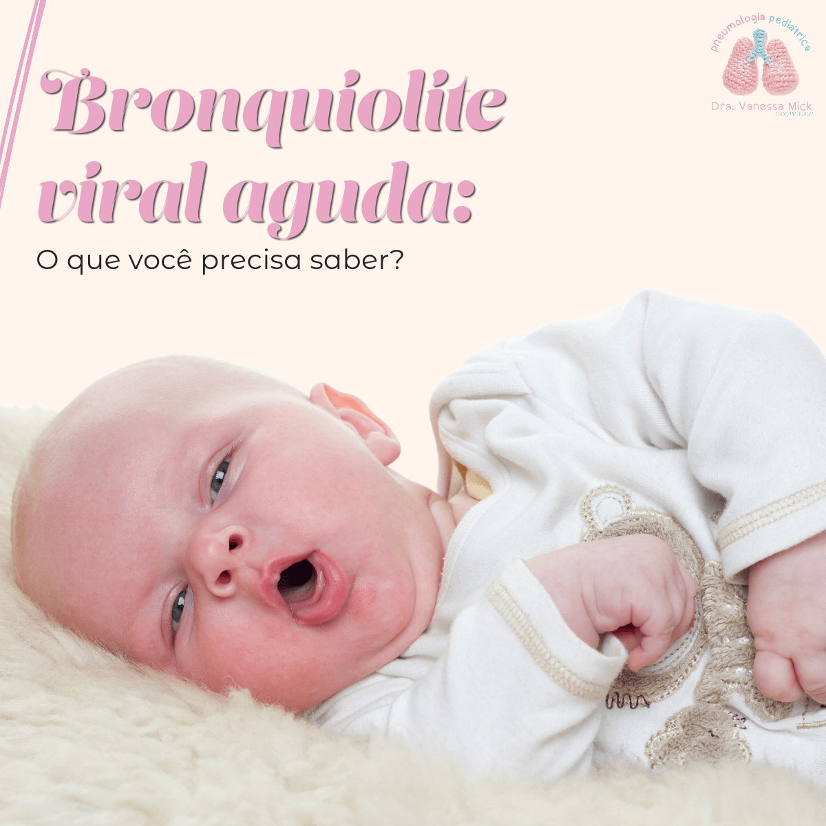 Bronquiolite viral aguda: o que você precisa saber?
