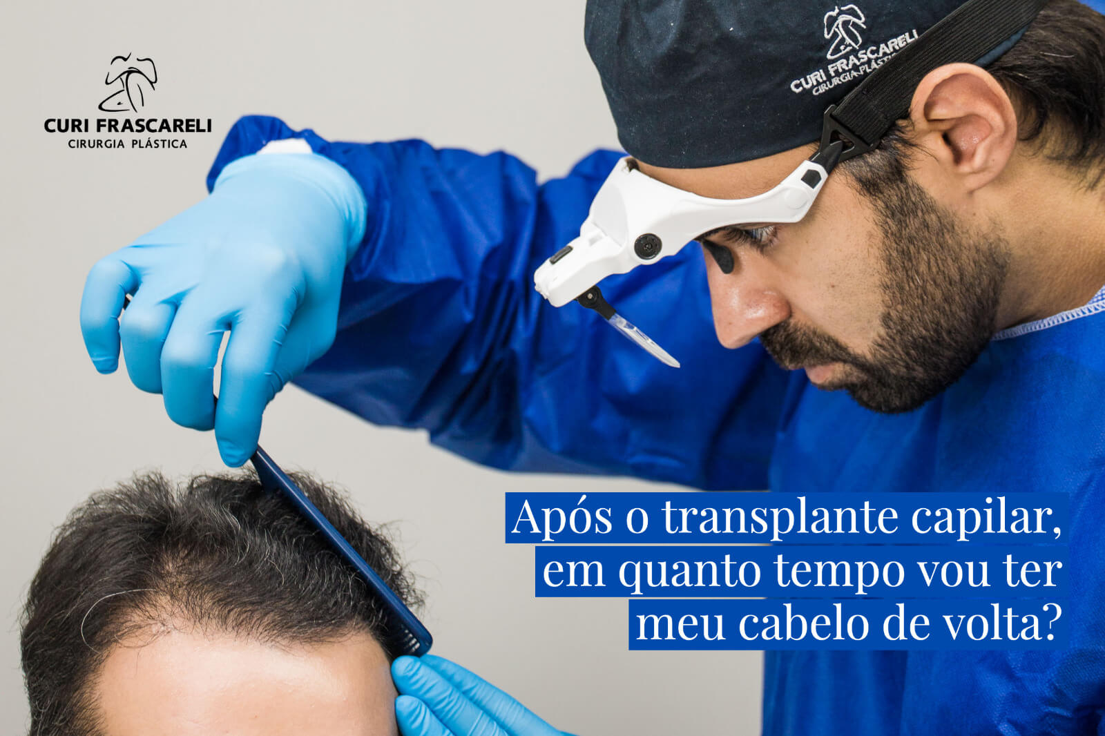 Após o transplante capilar, em quanto tempo vou ter meu cabelo de volta?