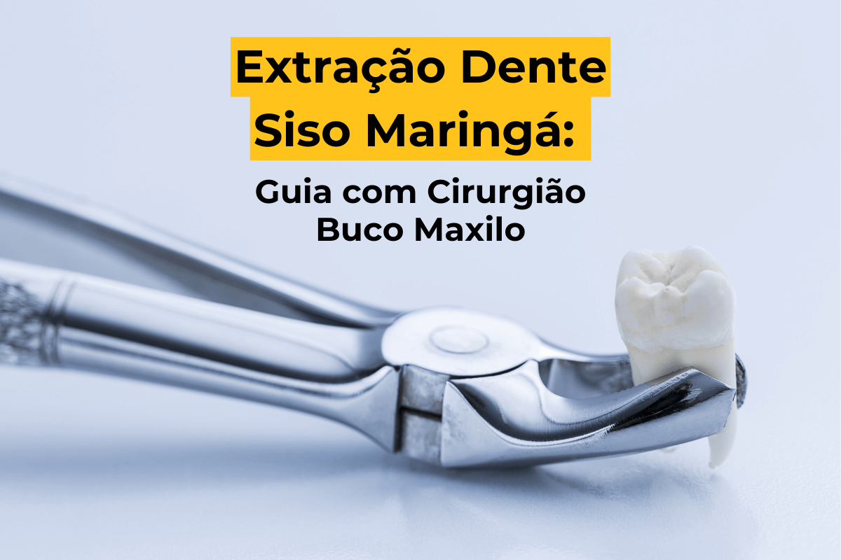 Extração Dente Siso Maringá: Guia com Cirurgião Buco Maxilo