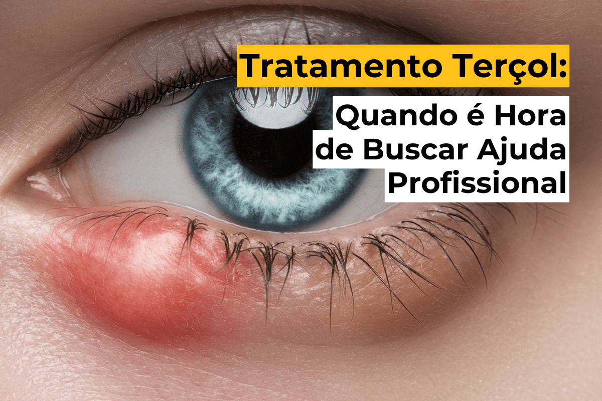 Tratamento Terçol em Maringá: Quando é Hora de Buscar Ajuda Profissional