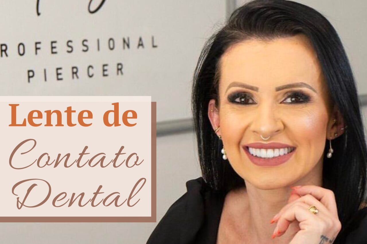 Lente de Contato Dental