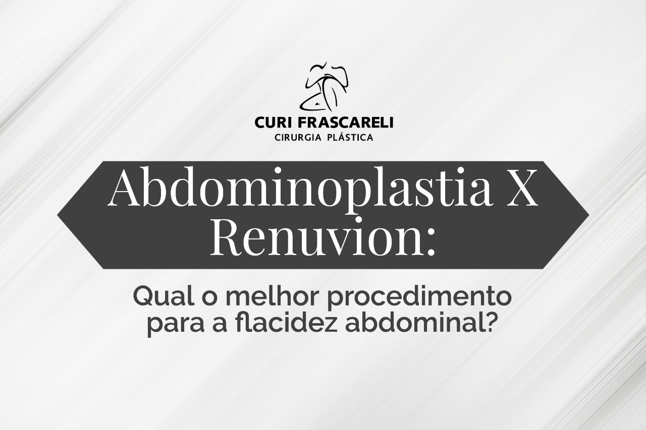 Abdominoplastia X Renuvion: Qual o melhor procedimento para a flacidez abdominal? 