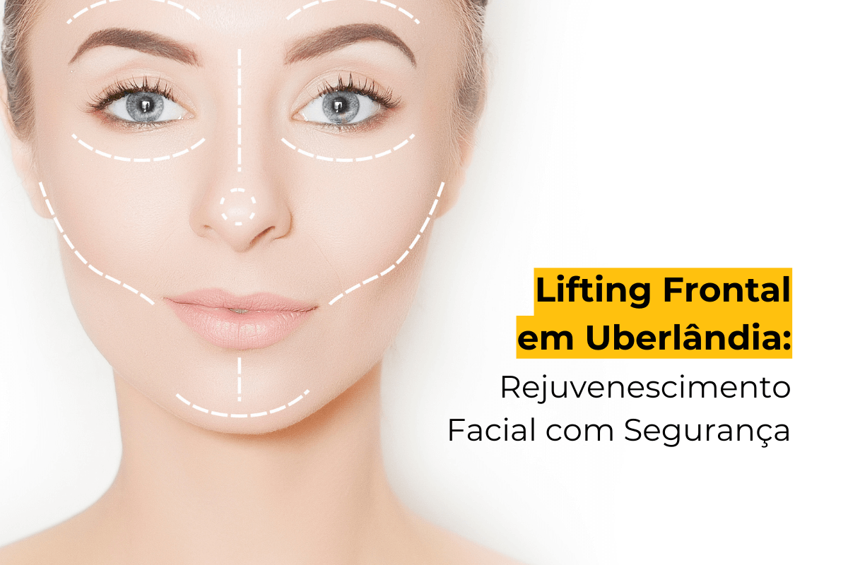 Lifting Frontal em Uberlândia: Rejuvenescimento Facial com Segurança