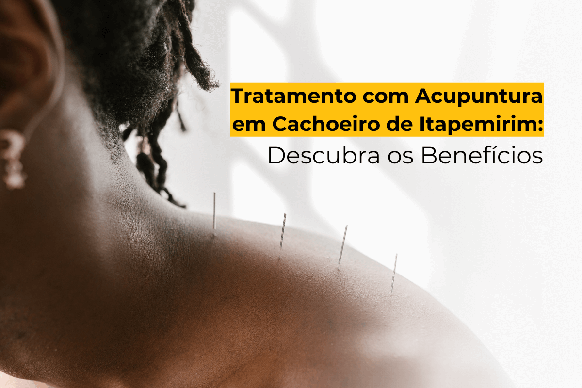 Tratamento com Acupuntura em Cachoeiro de Itapemirim: Descubra os Benefícios