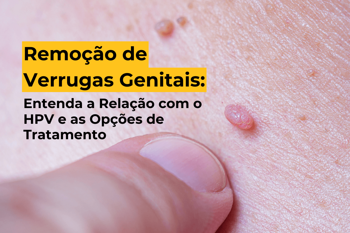Remoção de Verrugas Genitais em Umuarama: Entenda a Relação com o HPV e as Opções de Tratamento