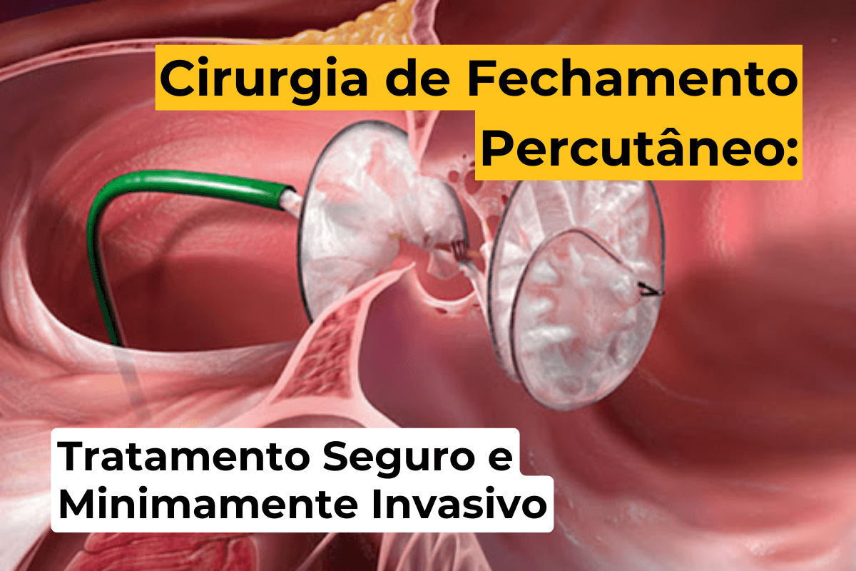 Cirurgia de Fechamento Percutâneo em Maringá: Tratamento Seguro e Minimamente Invasivo