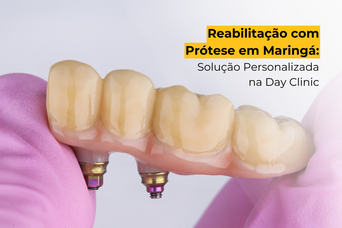 Reabilitação com Prótese em Maringá: Solução Personalizada na Day Clinic