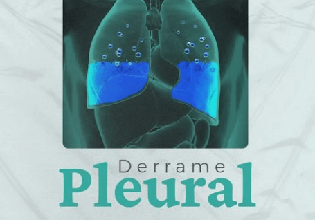 Derrame Pleural