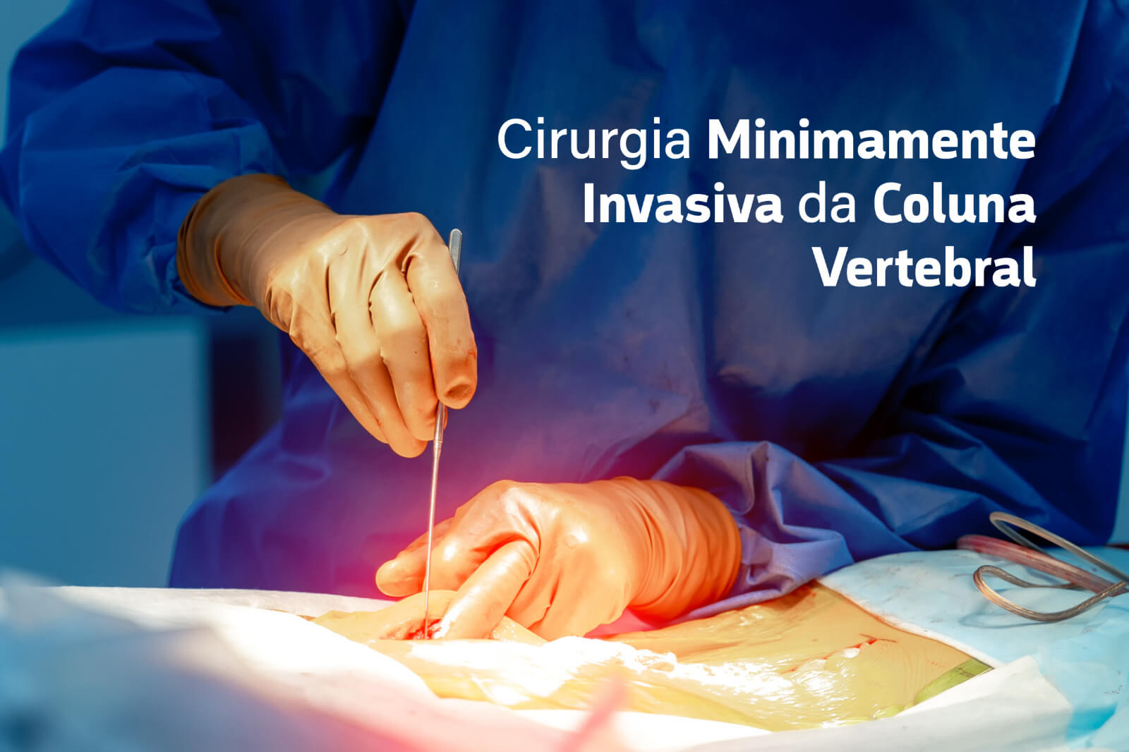  Cirurgia Minimamente Invasiva da Coluna Vertebral 