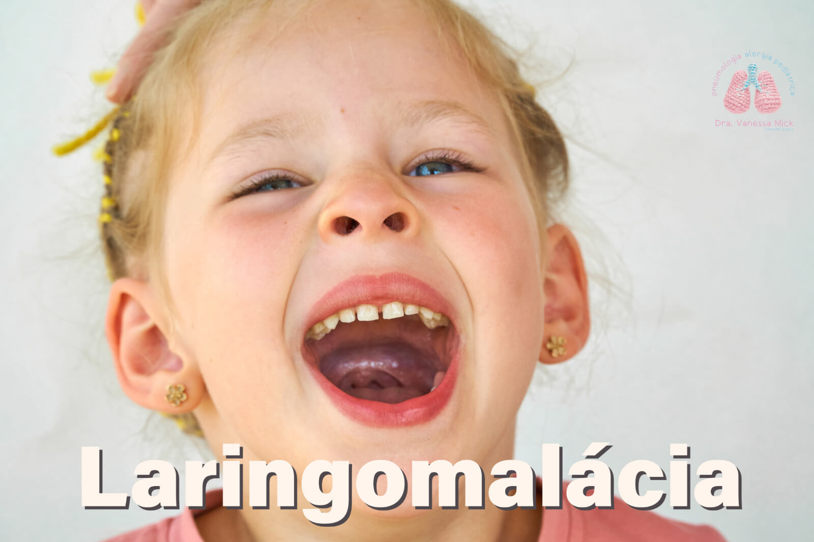 Laringomalácia
