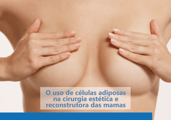 O uso de células adiposas na cirurgia estética e reconstrutora das mamas