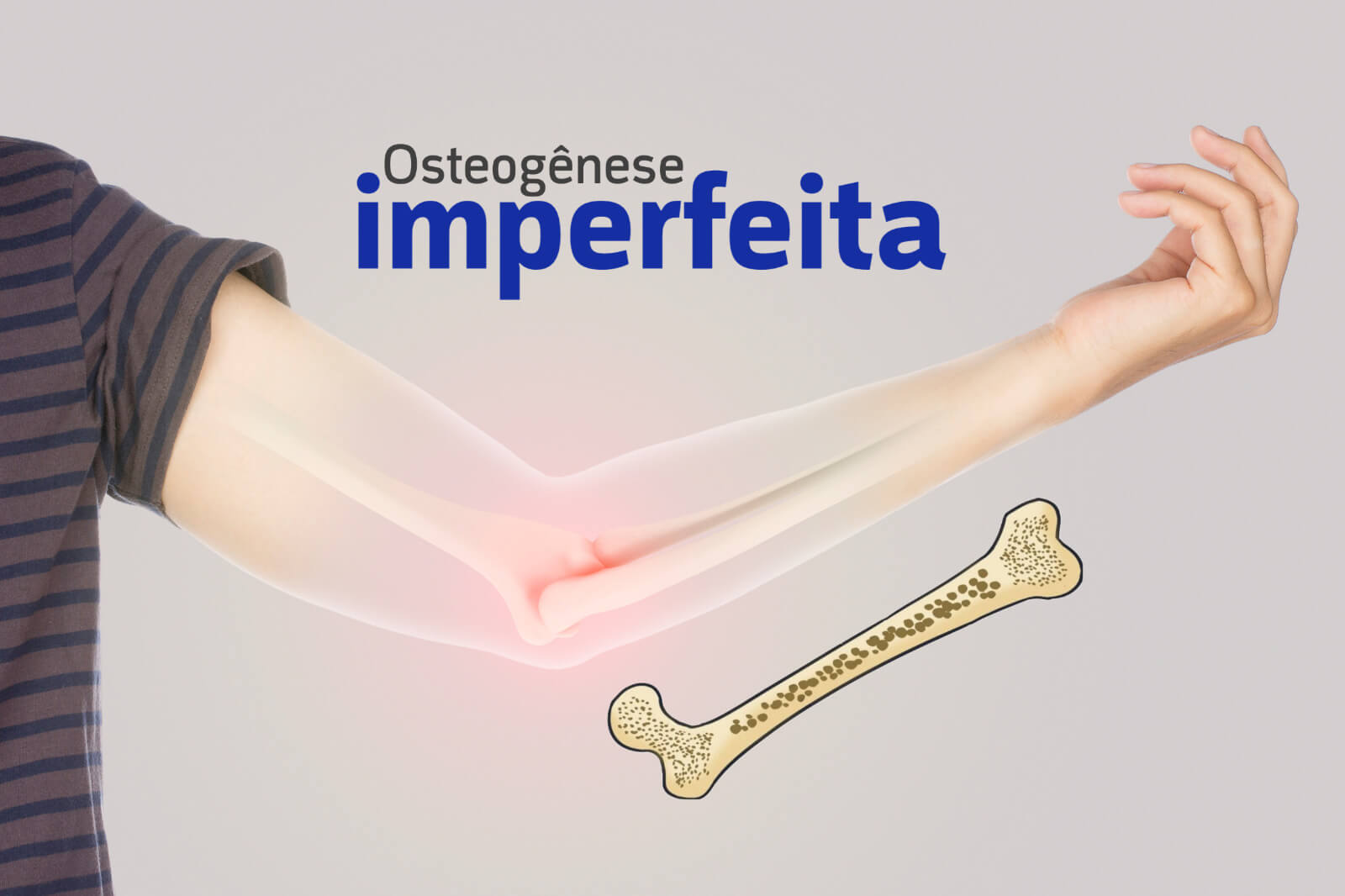 Osteogênese imperfeita