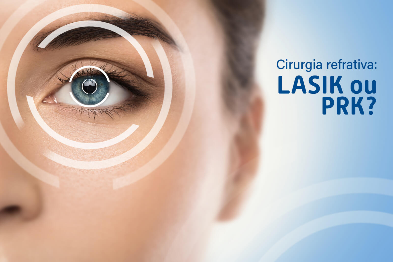 Cirurgia refrativa: LASIK ou PRK, qual é o melhor método?