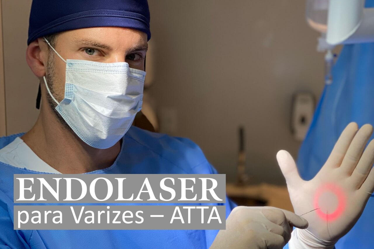 Endolaser para Varizes – ATTA