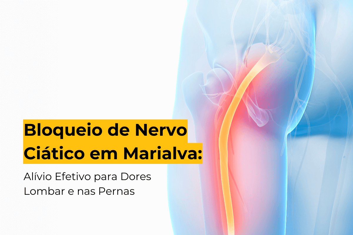 Bloqueio de Nervo Ciático em Marialva: Alívio Efetivo para Dores Lombar e nas Pernas
