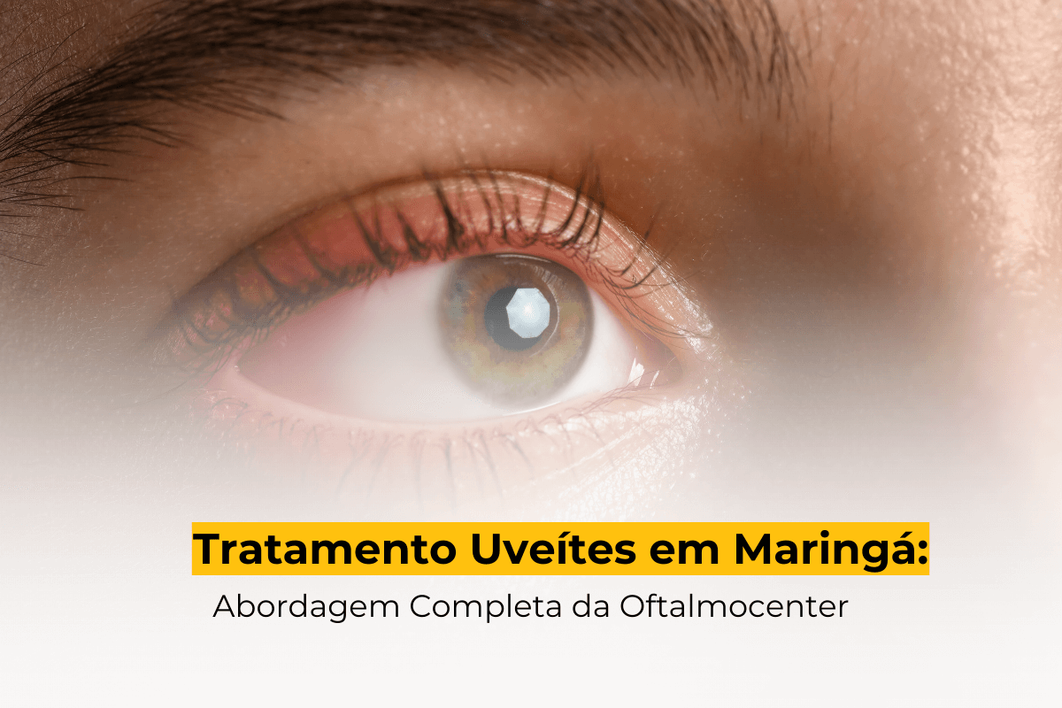 Tratamento Uveítes em Maringá: Abordagem Completa da Oftalmocenter