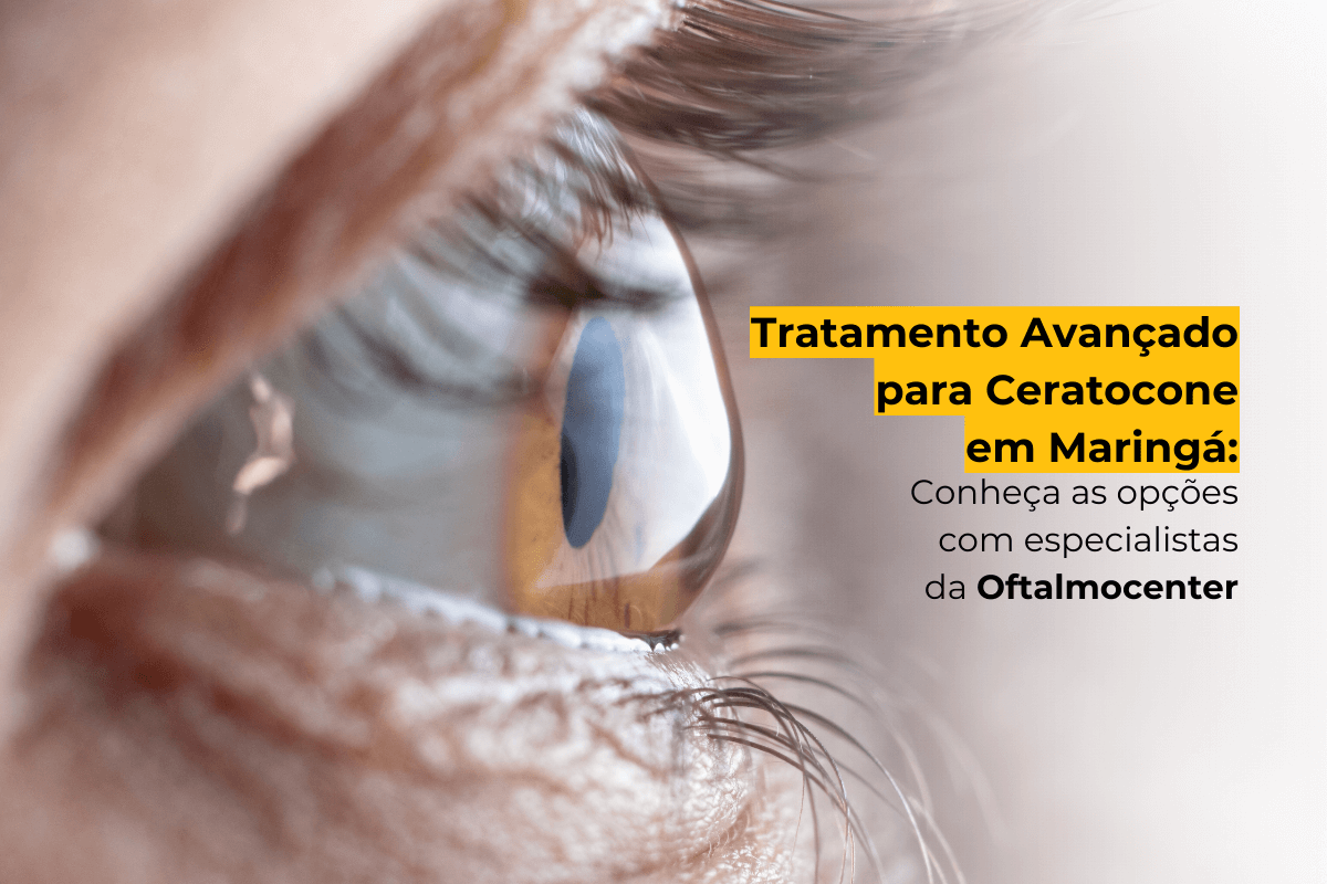 Tratamento Avançado para Ceratocone em Maringá: Conheça as Opções com Especialistas da Oftalmocenter