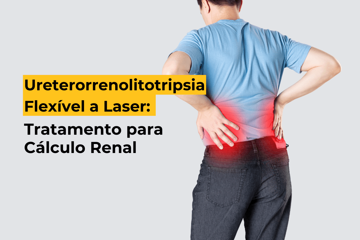 Ureterorrenolitotripsia Flexível a Laser em Umuarama: Tratamento para Cálculo Renal
