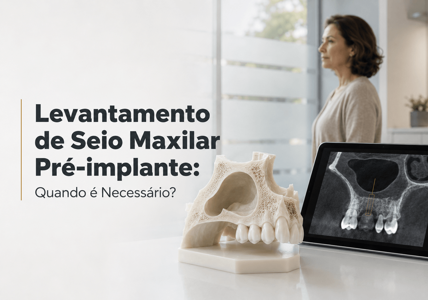 Levantamento de Seio Maxilar Pré-implante em Maringá: Quando é Necessário?