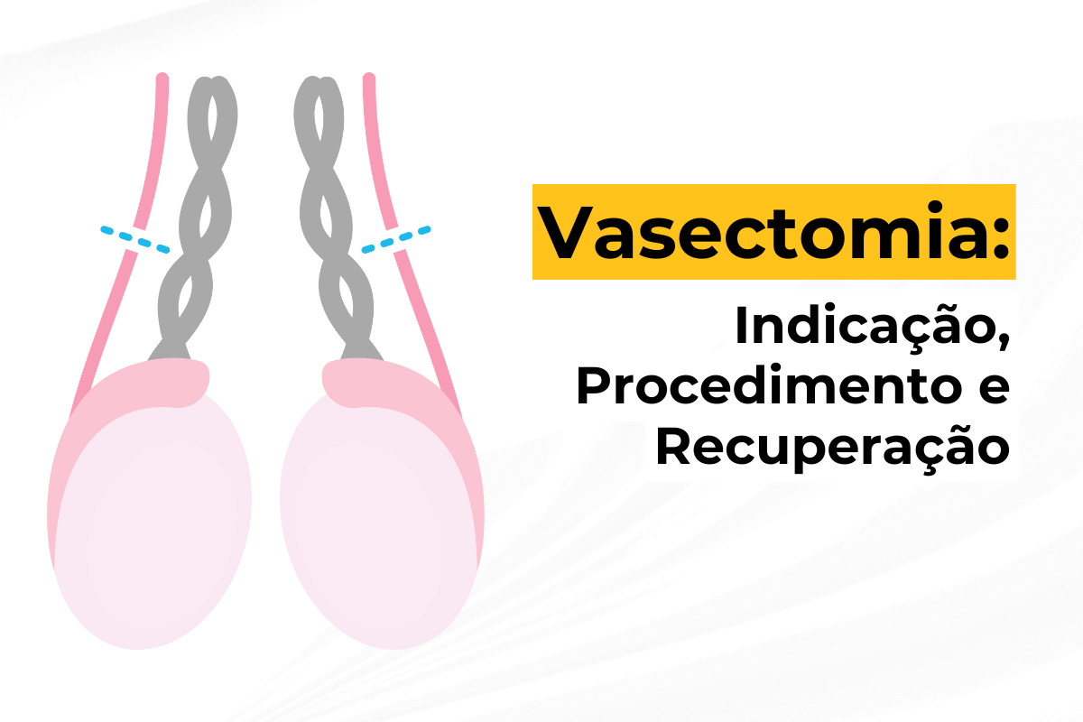 Vasectomia em Maringá: Indicação, Procedimento e Recuperação