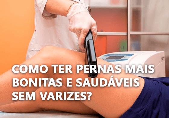 COMO TER PERNAS MAIS BONITAS E SAUDÁVEIS SEM VARIZES? 