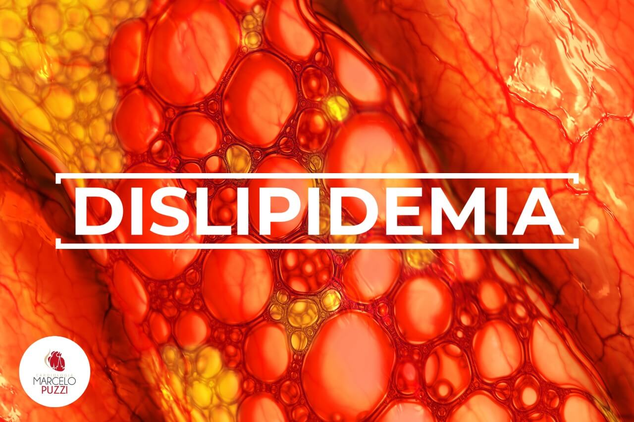 Dislipidemia