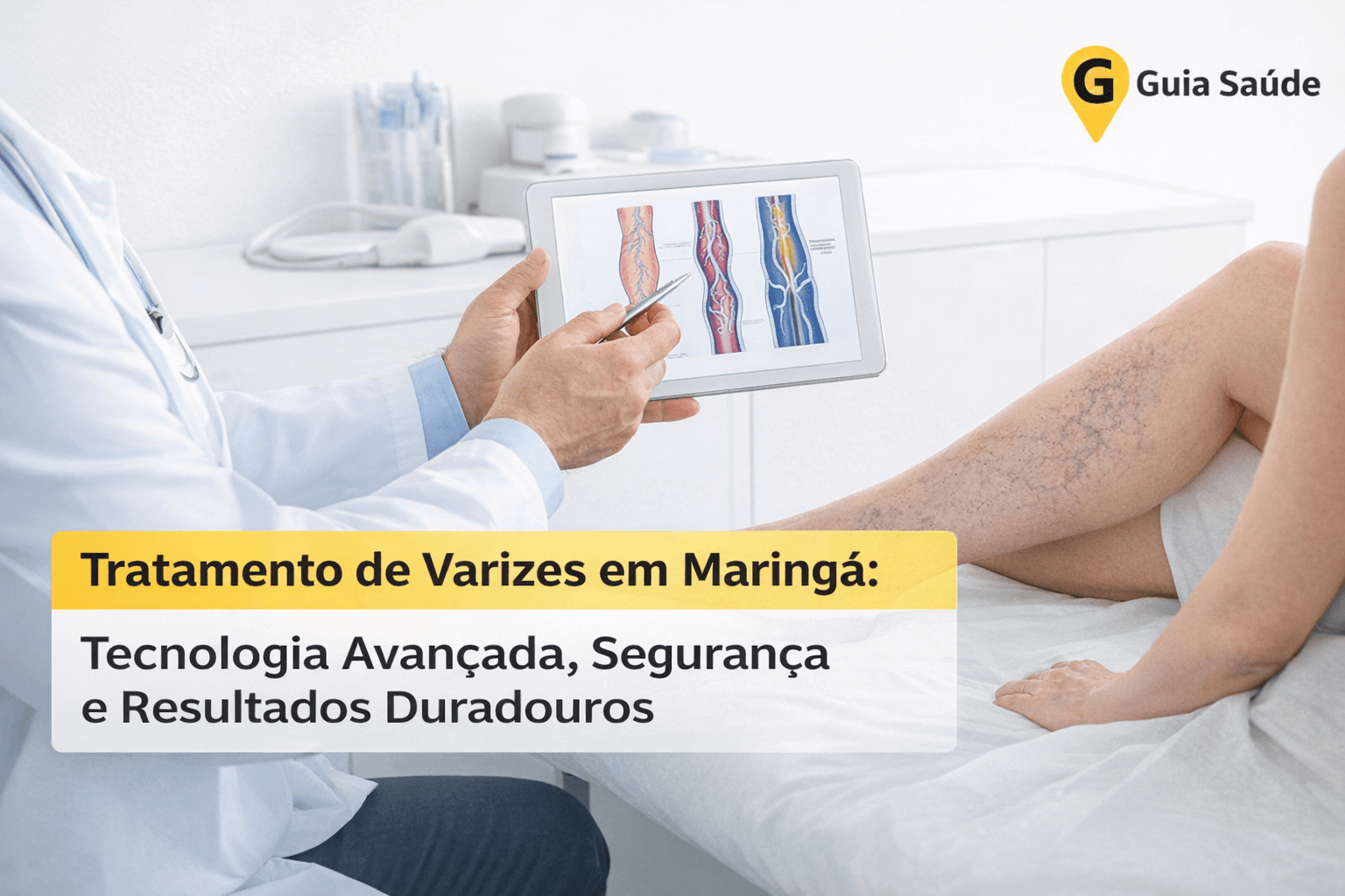 Tratamento de Varizes em Maringá: Tecnologia para Resultados Duradouros