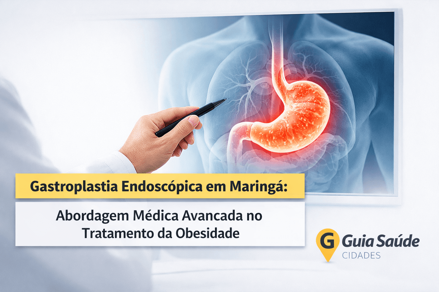 Gastroplastia Endoscópica em Maringá: Abordagem Médica Avançada no Tratamento da Obesidade