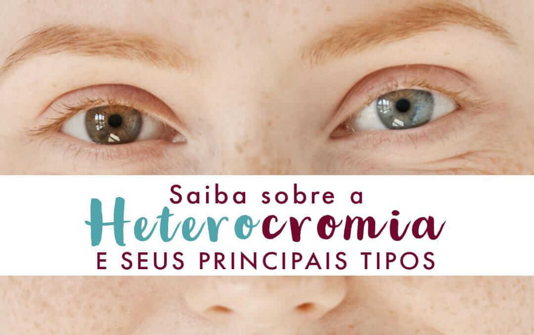 Heterocromia