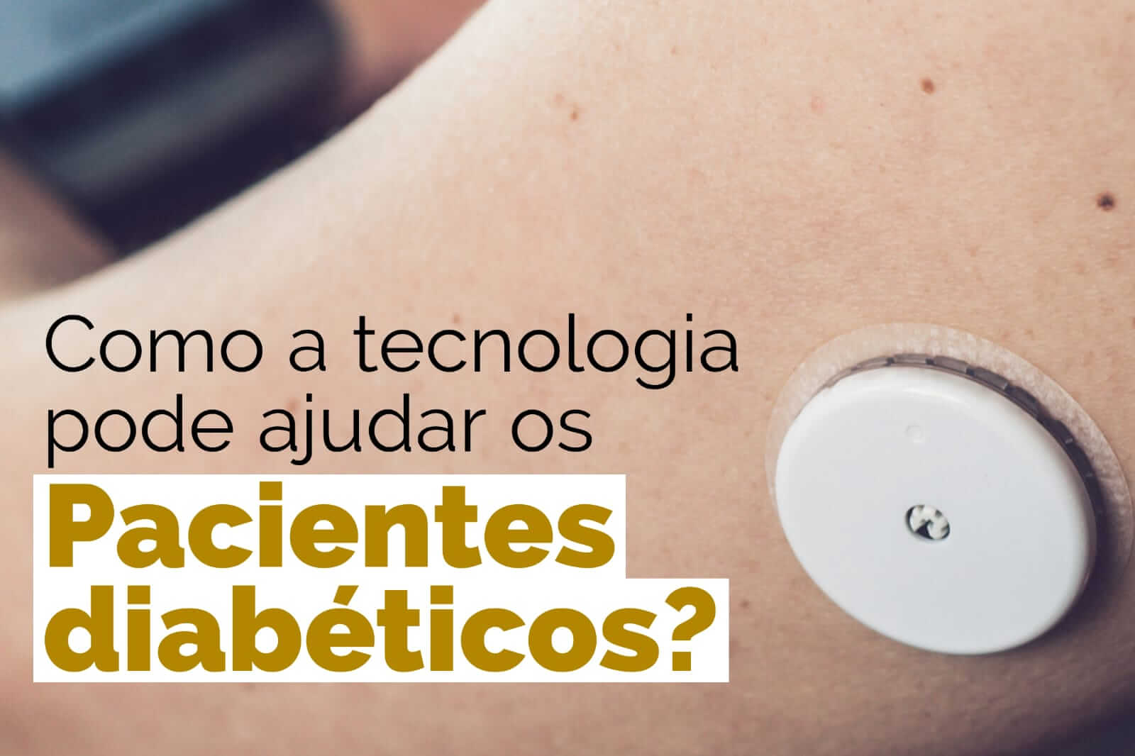 Como a tecnologia pode ajudar os pacientes diabéticos? - Maringá
